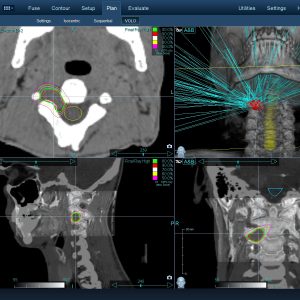 Νευρίνωμα 003 Θεραπεία με CyberKnife Νευρίνωμα 003 Θεραπεία με CyberKnife