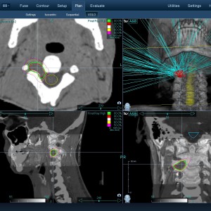Νευρίνωμα 003 Θεραπεία με CyberKnife Νευρίνωμα 003 Θεραπεία με CyberKnife